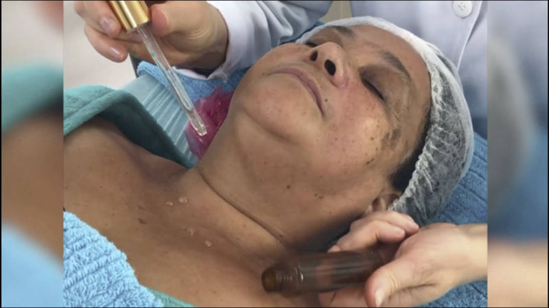 Harmonização Facial Isabel Piatti